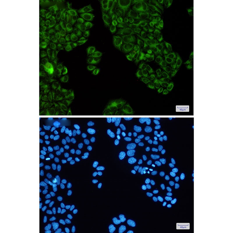 SERCA2 ATPase Rabbit mAb抗体,orb