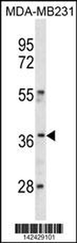 HOXC10 Antibody (C-term)抗体,orb