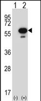 Mouse Stk25 Antibody (C-term)抗