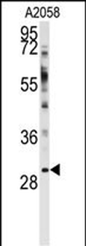 WBP2 Antibody (N-term)抗体，orb38