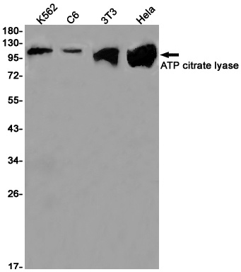 ATP Citrate lyase Rabbit mAb抗体