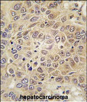 MARS Antibody (C-term)抗体，orb38