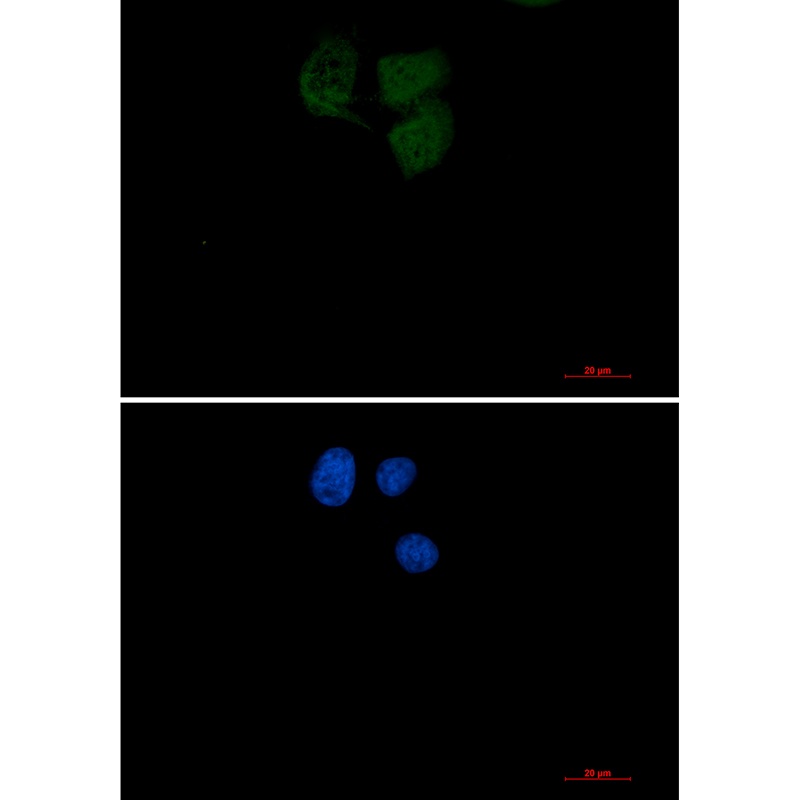 Ubiquitin Conjugating Enzyme E