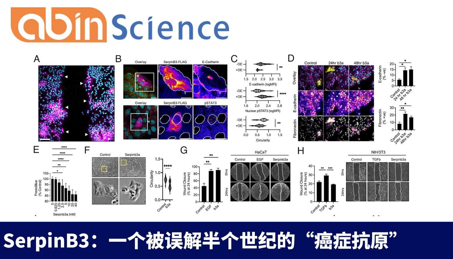 SerpinB3：一个被误解半个世纪的“癌症抗原”，其实是皮肤的自愈信号