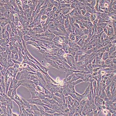 SUM-159PT人三阴性乳腺癌细胞(STR鉴定)丨逸漠(immocell)