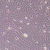 SUM-159PT人三阴性乳腺癌细胞(STR鉴定)丨逸漠(immocell)