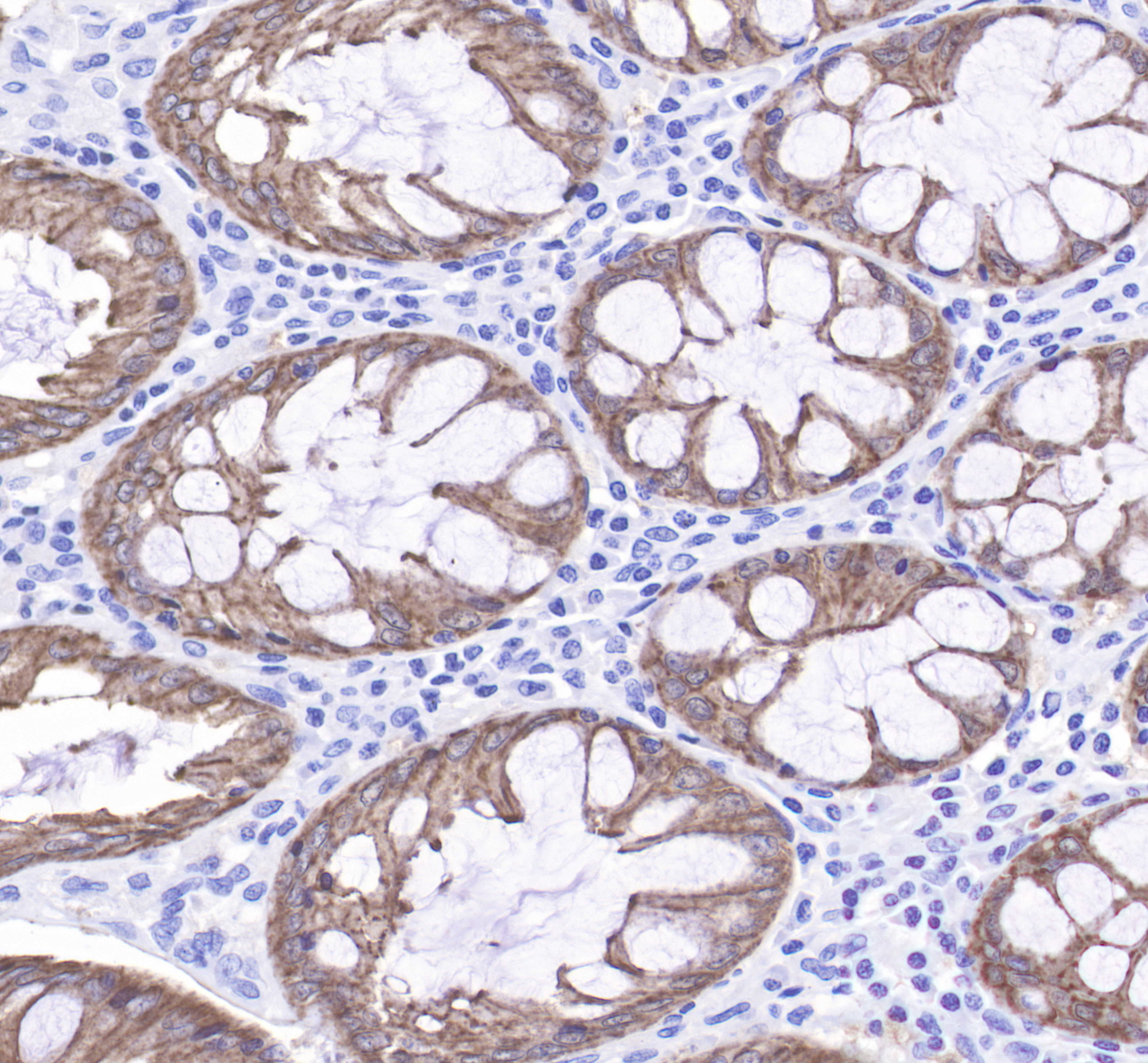 Villin 抗体在消化道发育与肿瘤研究中的核心应用:Absin 兔单克隆抗体(abs171588)深度解析