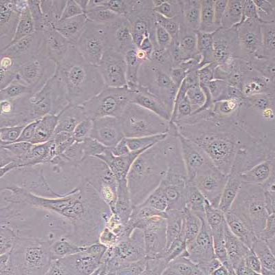 NCI-H3255人肺癌细胞(STR鉴定)丨逸漠(immocell)产品图