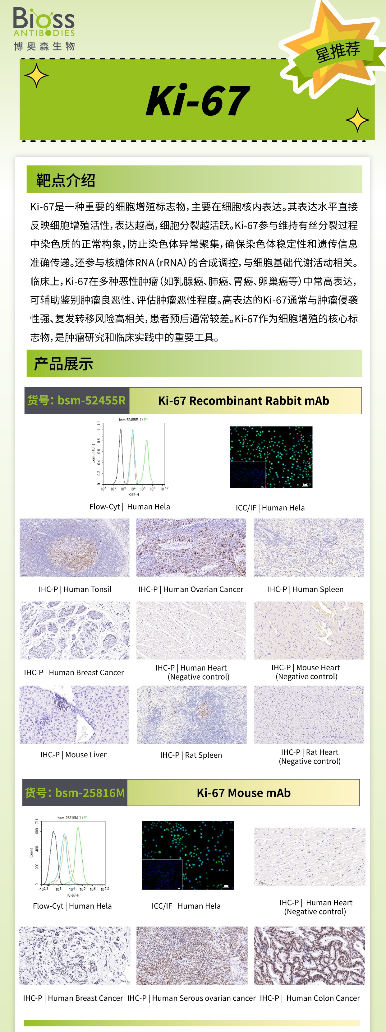 博奥森星推荐 | Ki-67 抗体