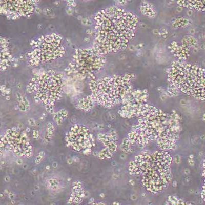 Raji人淋巴瘤细胞(STR鉴定)丨逸漠(immocell)
