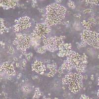 Raji人淋巴瘤细胞(STR鉴定)丨逸漠(immocell)