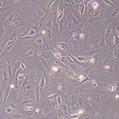 HIBEpiCs-SV40T人肝内胆管上皮细胞永生化(STR鉴定)丨逸漠(immocell)