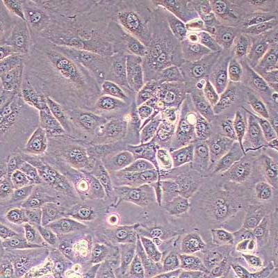 OV56人卵巢癌细胞(STR鉴定)丨逸漠(immocell)