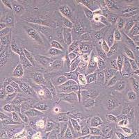 OV56人卵巢癌细胞(STR鉴定)丨逸漠(immocell)