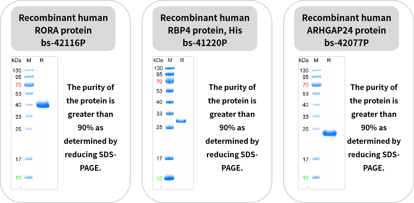精品推荐 | 博奥森 Rrmab®重组兔单克隆抗体