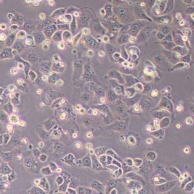 IGROV1人卵巢癌细胞(STR鉴定)丨逸漠(immocell)