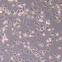 IGROV1人卵巢癌细胞(STR鉴定)丨逸漠(immocell)