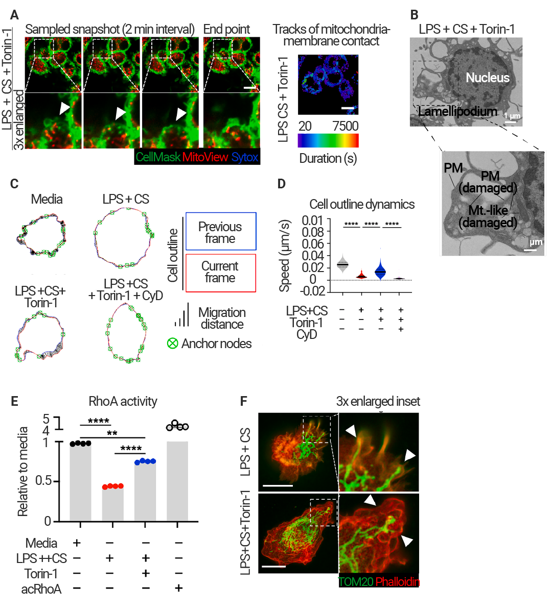 前沿进展 ｜ Cell 新发现：Mitoxyperilysis —— 新的细胞溶解性死亡途径