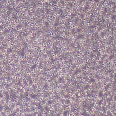 OCI-LY19人B细胞淋巴瘤(STR鉴定)丨逸漠(immocell)