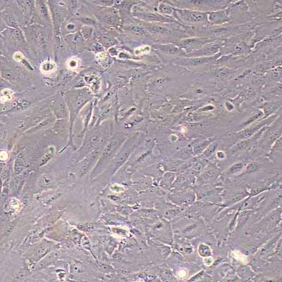 ETK-1人肝内胆管癌细胞(STR鉴定)丨逸漠(immocell)