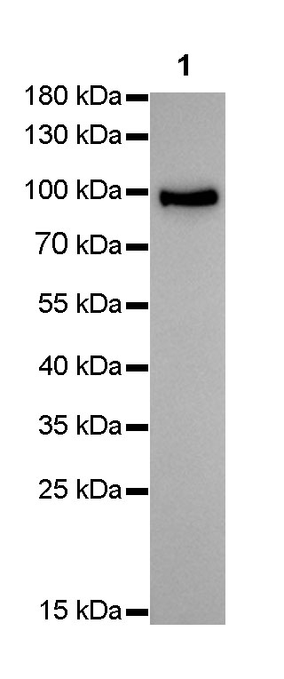 Villin 抗体在消化道发育与肿瘤研究中的核心应用:Absin 兔单克隆抗体(abs171588)深度解析