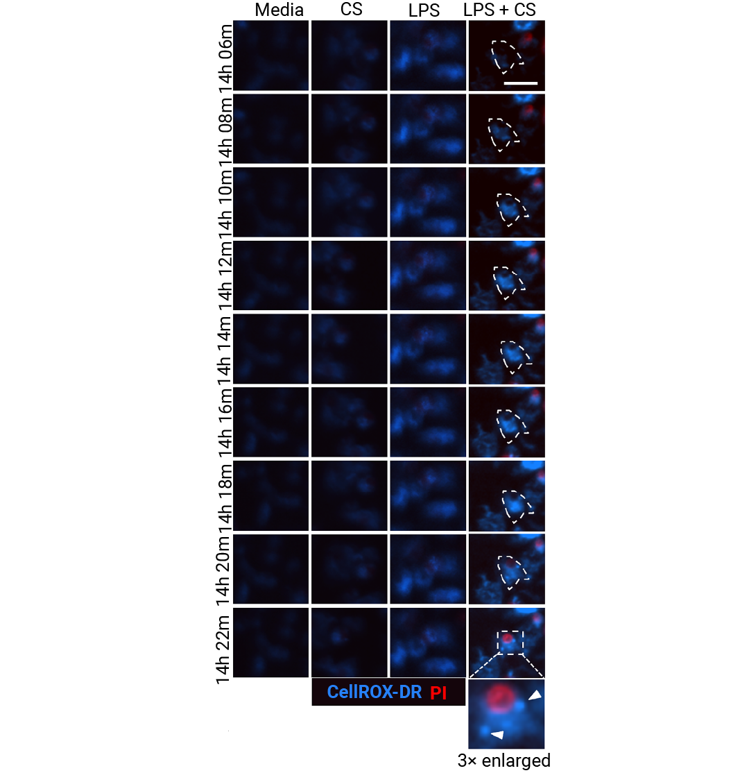 前沿进展 ｜ Cell 新发现：Mitoxyperilysis —— 新的细胞溶解性死亡途径