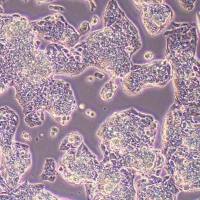 HepAD38人肝癌细胞(STR鉴定)丨逸漠(immocell)