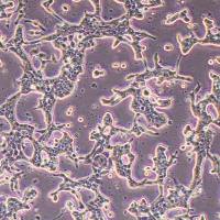 SNU-719人胃癌细胞(STR鉴定)丨逸漠(immocell)