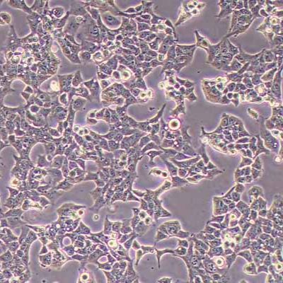 KYSE-70人食管鳞状细胞癌细胞(STR鉴定)丨逸漠(immocell)