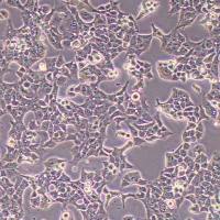 KYSE-70人食管鳞状细胞癌细胞(STR鉴定)丨逸漠(immocell)