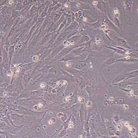 人巩膜成纤维细胞永生化(STR鉴定)丨逸漠(immocell)