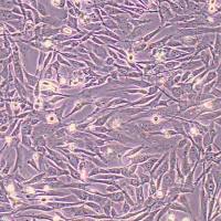 人子宫内膜基质细胞永生化(STR鉴定)丨逸漠(immocell)