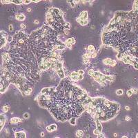 Ls513人结直肠癌细胞(STR鉴定)丨逸漠(immocell)