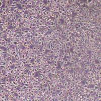 LP-1人多发性骨髓瘤(浆细胞骨髓瘤)(STR鉴定)丨逸漠(immocell)