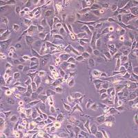 SUM149PT人乳腺癌细胞(STR鉴定)丨逸漠(immocell)