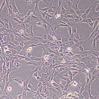 人骨髓间充质干细胞永生化(STR鉴定)丨逸漠(immocell)