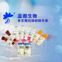 甲状腺旁激素PTH（重组和天然）甲状腺旁激素PTH抗原  甲状腺旁激素PTH重组蛋白