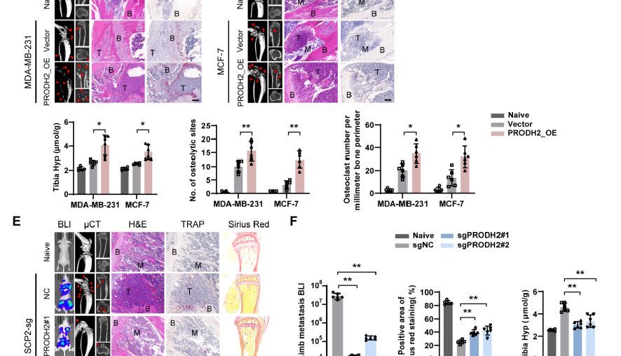 【IF 16.6】破解乳腺癌骨转移“恶性循环”！Absin代谢检测试剂盒助力PRODH2机制研究登顶科研前沿