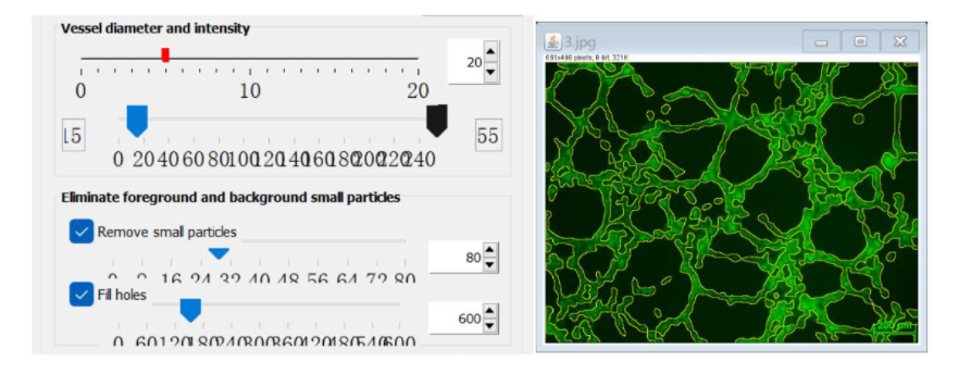血管形成实验 —— 精通篇