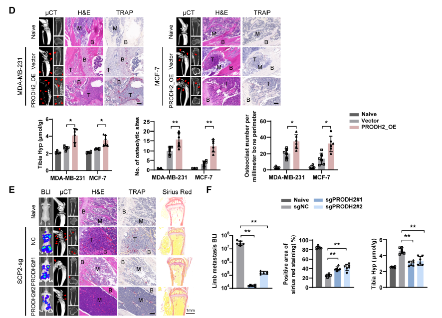 【IF 16.6】破解乳腺癌骨转移“恶性循环”!Absin代谢检测试剂盒助力PRODH2机制研究登顶科研前沿