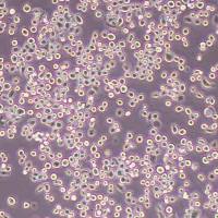 NUGC-4人胃癌细胞(STR鉴定)丨逸漠(immocell)