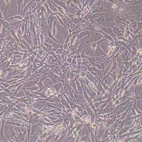 1321N1人脑部多形性成釉细胞瘤细胞(STR鉴定)丨逸漠(immocell)