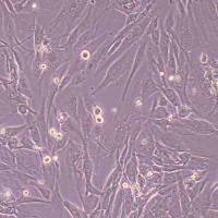 人输尿管平滑肌细胞永生化(STR鉴定)丨逸漠(immocell)