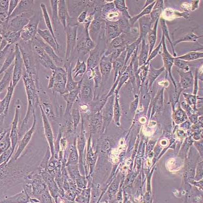 人子宫平滑肌细胞永生化(STR鉴定)丨逸漠(immocell)