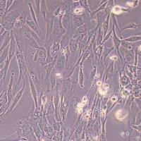 人子宫平滑肌细胞永生化(STR鉴定)丨逸漠(immocell)