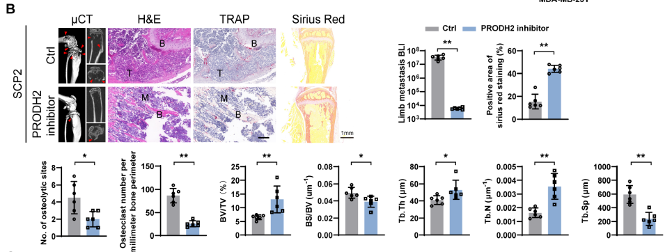【IF 16.6】破解乳腺癌骨转移“恶性循环”!Absin代谢检测试剂盒助力PRODH2机制研究登顶科研前沿