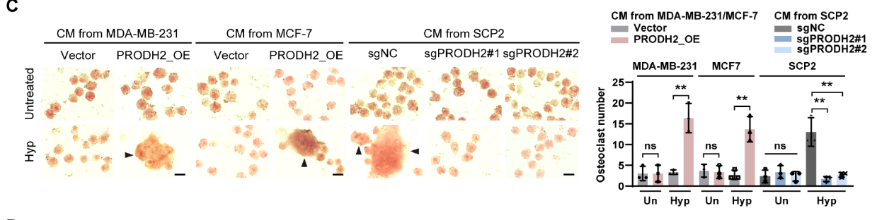 【IF 16.6】破解乳腺癌骨转移“恶性循环”!Absin代谢检测试剂盒助力PRODH2机制研究登顶科研前沿