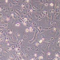 OVCAR-4人卵巢癌细胞(STR鉴定)丨逸漠(immocell)