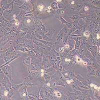 HCC38乳腺导管癌细胞(STR鉴定)丨逸漠(immocell)