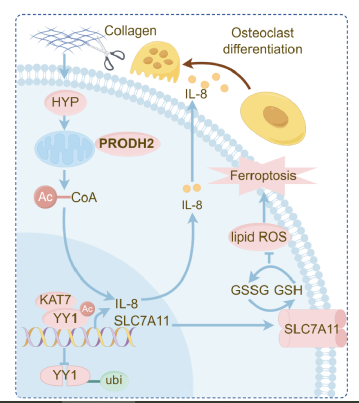 【IF 16.6】破解乳腺癌骨转移“恶性循环”!Absin代谢检测试剂盒助力PRODH2机制研究登顶科研前沿